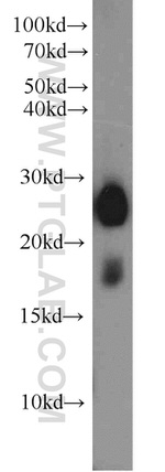 LY6K Antibody in Western Blot (WB)