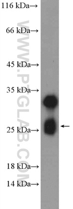 STMN4 Antibody in Western Blot (WB)