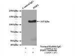 POP1 Antibody in Immunoprecipitation (IP)
