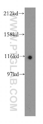 POP1 Antibody in Western Blot (WB)