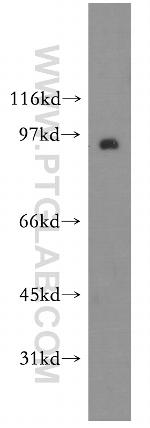 Synaptotagmin-11 Antibody in Western Blot (WB)