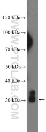 KCNIP3 Antibody in Western Blot (WB)
