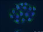 KCNIP3 Antibody in Immunocytochemistry (ICC/IF)