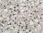 KCNIP3 Antibody in Immunohistochemistry (Paraffin) (IHC (P))