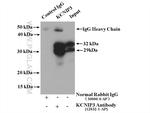 KCNIP3 Antibody in Immunoprecipitation (IP)