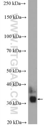 KCNIP3 Antibody in Western Blot (WB)