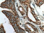 TM7SF2 Antibody in Immunohistochemistry (Paraffin) (IHC (P))