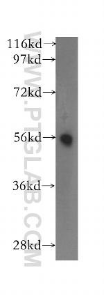 TM7SF2 Antibody in Western Blot (WB)