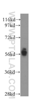 TM7SF2 Antibody in Western Blot (WB)