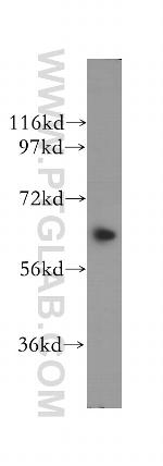 KIF12 Antibody in Western Blot (WB)