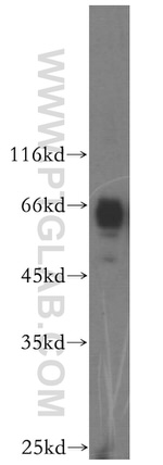KIF12 Antibody in Western Blot (WB)