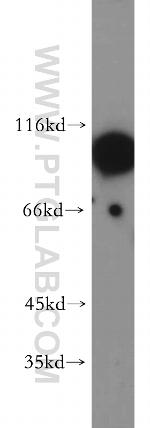HURP Antibody in Western Blot (WB)