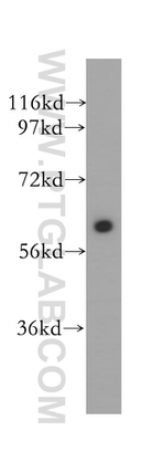 SLC38A1 Antibody in Western Blot (WB)