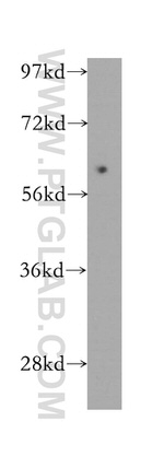 SLC38A1 Antibody in Western Blot (WB)