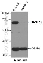 SLC38A1 Antibody in Western Blot (WB)