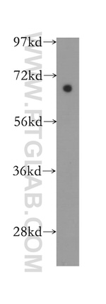 SLC38A1 Antibody in Western Blot (WB)
