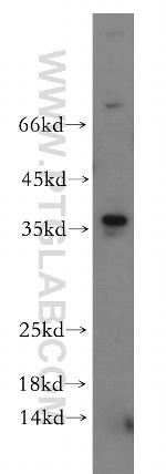 MLX Antibody in Western Blot (WB)