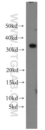 MLX Antibody in Western Blot (WB)