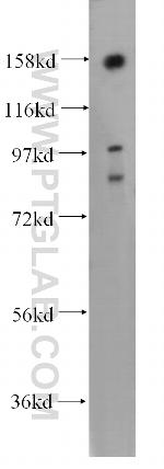 NOL8 Antibody in Western Blot (WB)
