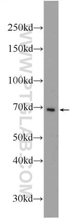 PCSK7 Antibody in Western Blot (WB)
