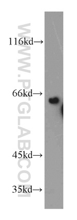 DTNB Antibody in Western Blot (WB)