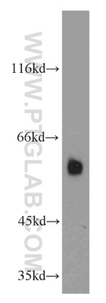 DTNB Antibody in Western Blot (WB)