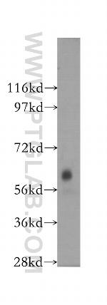 DTNB Antibody in Western Blot (WB)