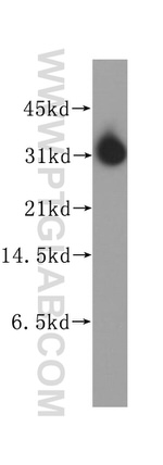 STOM Antibody in Western Blot (WB)