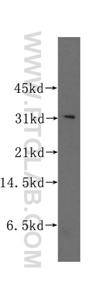 STOM Antibody in Western Blot (WB)