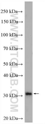 STOM Antibody in Western Blot (WB)