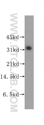 STOM Antibody in Western Blot (WB)