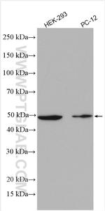 CHN1 Antibody in Western Blot (WB)