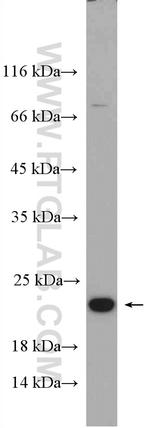 CBFB Antibody in Western Blot (WB)