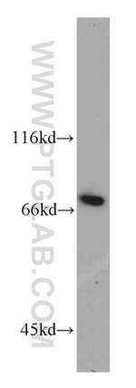 SLU7 Antibody in Western Blot (WB)