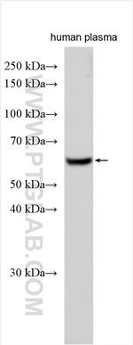 APBB3 Antibody in Western Blot (WB)