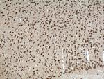 PELI1 Antibody in Immunohistochemistry (Paraffin) (IHC (P))