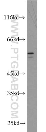 BRF2 Antibody in Western Blot (WB)