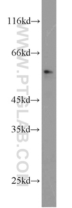 BRF2 Antibody in Western Blot (WB)