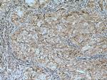 IP6K1 Antibody in Immunohistochemistry (Paraffin) (IHC (P))