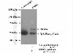 IP6K1 Antibody in Immunoprecipitation (IP)