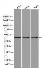 IP6K1 Antibody in Western Blot (WB)