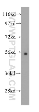 IP6K1 Antibody in Western Blot (WB)