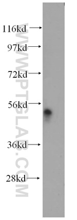 IP6K1 Antibody in Western Blot (WB)