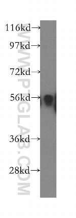 IP6K1 Antibody in Western Blot (WB)