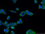 ODF2 Antibody in Immunocytochemistry (ICC/IF)