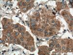 ODF2 Antibody in Immunohistochemistry (Paraffin) (IHC (P))