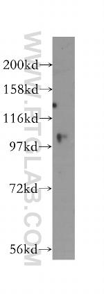USP33 Antibody in Western Blot (WB)