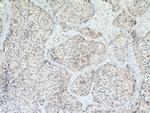 RARRES3 Antibody in Immunohistochemistry (Paraffin) (IHC (P))
