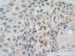 RARRES3 Antibody in Immunohistochemistry (Paraffin) (IHC (P))
