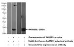RARRES3 Antibody in Western Blot (WB)